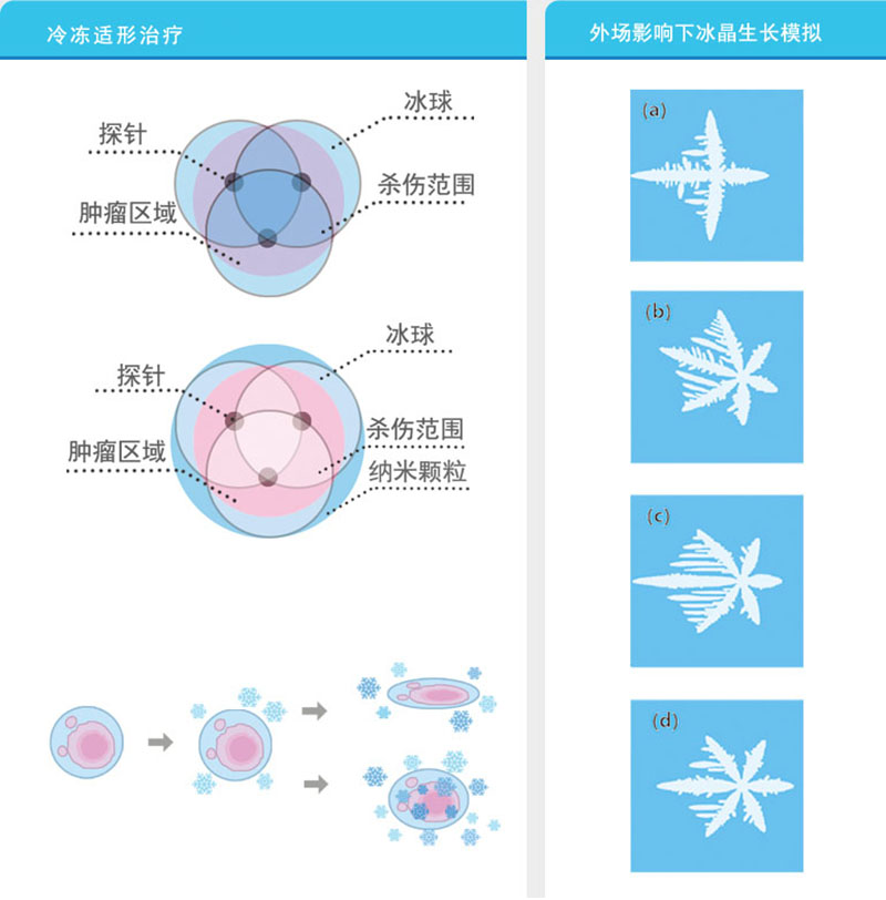 1622623945274800.jpg 低溫冷凍治療系統(tǒng)2.jpg